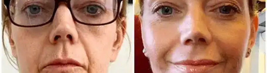 Breast Augmentation Surgeon