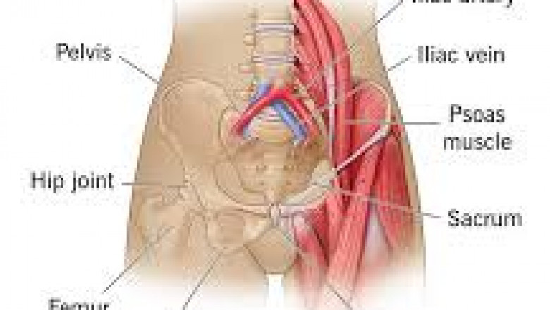 Understanding Side Hip Pain: How Tapaday 100 mg (Tapentadol) Can Help