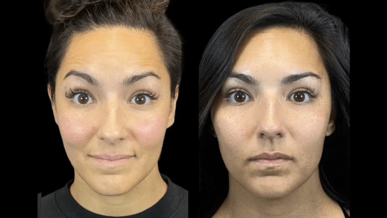 How Technology Is Elevating Results at the Best Aesthetic Clinic in Dubai