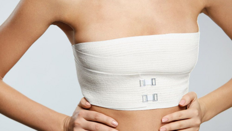 Considering Breast Reduction Here’s What You Need to Know