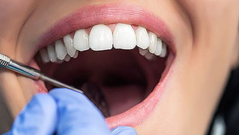 Comprehensive Guide to Finding the Right Dentist in Mernda